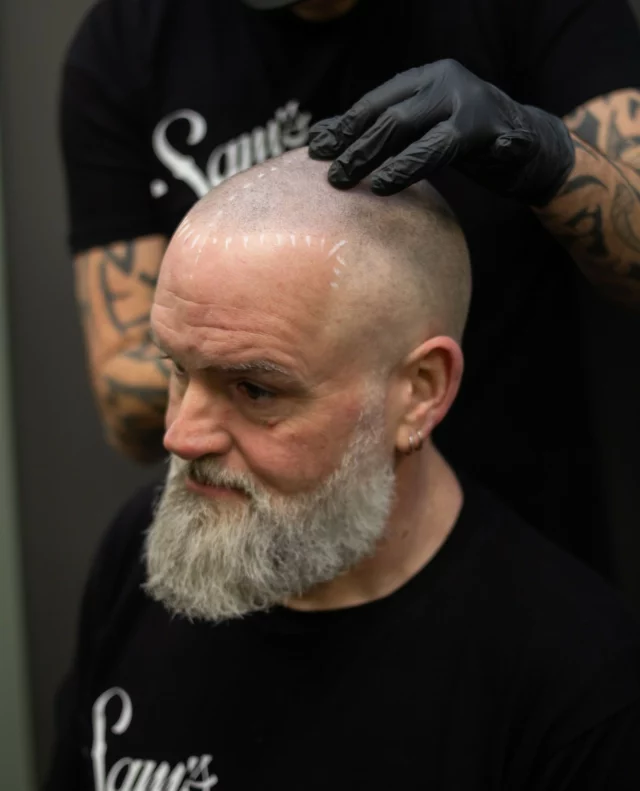 With Scalp Micropigmentation at Sam's Barbers - we can give you the look of fuller hair with no surgery or no downtime. 💯⁠
⁠
Get in contact today and see how we can make a difference for you! 📞⁠
⁠
Call on: 015552220