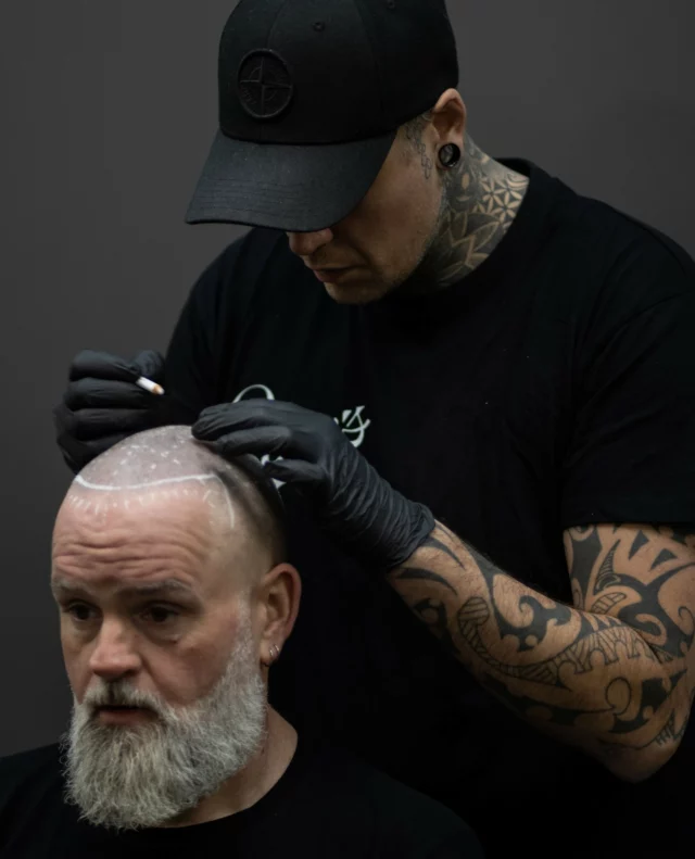 With Scalp Micropigmentation, what you see is confidence - restored.⁠
⁠
Realistic. Clean. You, upgraded.⁠
⁠
✅️ Natural look⁠
✅️ Immediate results⁠
✅️ Long-lasting confidence⁠
⁠
This isn’t just a fix. It’s a fresh start.⁠
⁠
If you want to know more information, drop us a message or give us a call on 015552220 for more information 📞